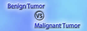 Benign Tumor vs Malignant Tumor