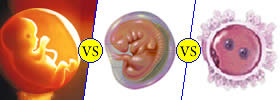 Foetus vs Embryo vs Zygote