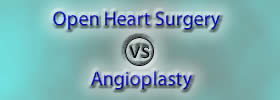 Open Heart Surgery vs Angioplasty
