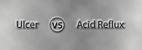 Ulcer vs Acid Reflux