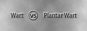 Wart vs Plantar Wart