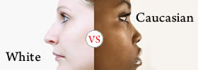 White vs Caucasian