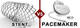 Stent vs Pacemaker