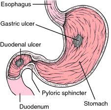 Gastric