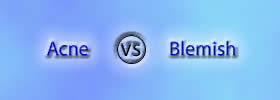 Acne vs Blemish