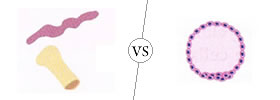Adult Stem Cells vs Embryonic Stem Cells