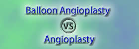 Balloon Angioplasty vs Angioplasty