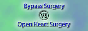 Bypass Surgery vs Open Heart Surgery