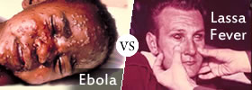Ebola vs Lassa Fever