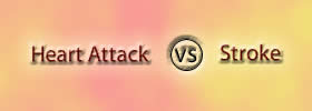 Heart Attack vs Stroke