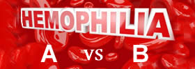 Hemophilia A vs Hemophilia B