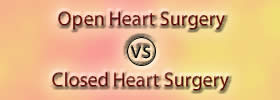 Open Heart Surgery vs Closed Heart Surgery