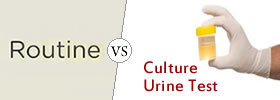 Routine Urine Test vs Culture Urine Test